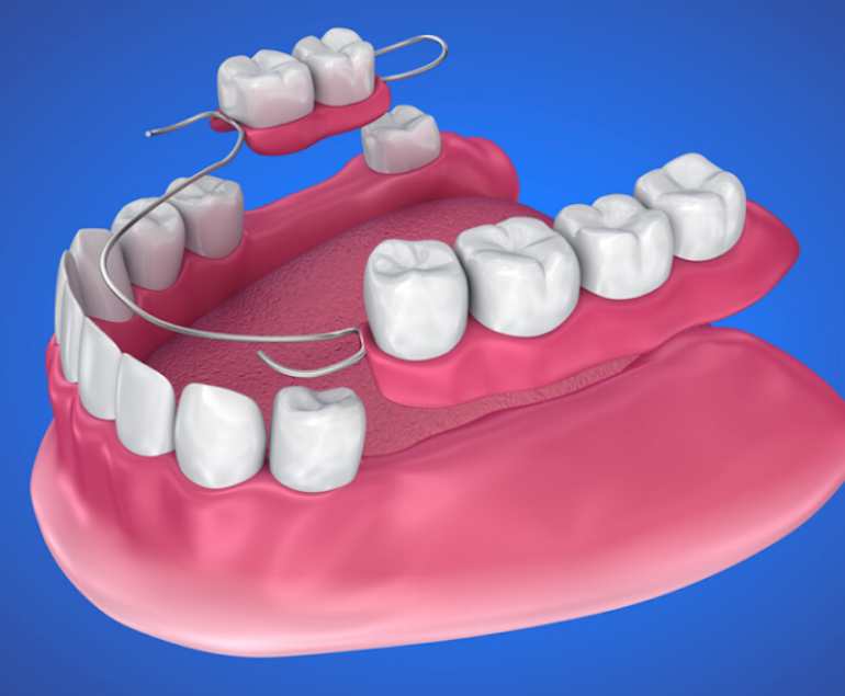 Complete and partial dentures